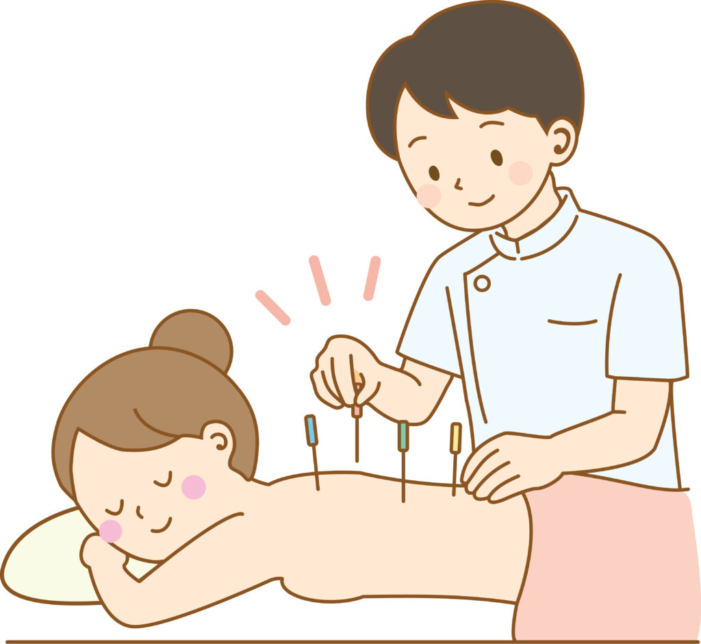 鍼施術